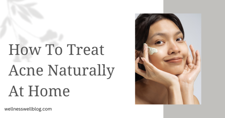 How To Treat Acne Naturally At Home